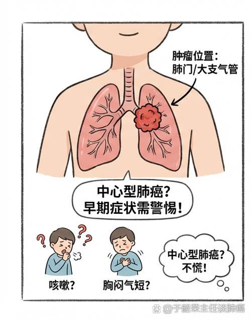肺部肿瘤怎么治疗效果最好
