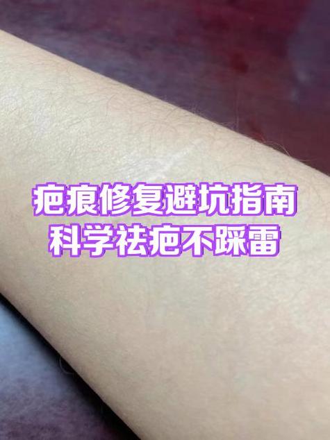 结痂掉了凸起来的疤痕怎么办