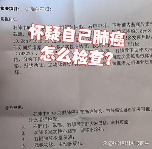 肺部肿瘤良性的几率是多少