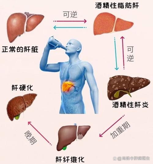 肝界下移会是肝癌吗