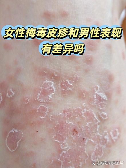 女性皮肤与男性皮肤有差别吗