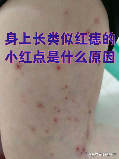 长小红点点是什么原因