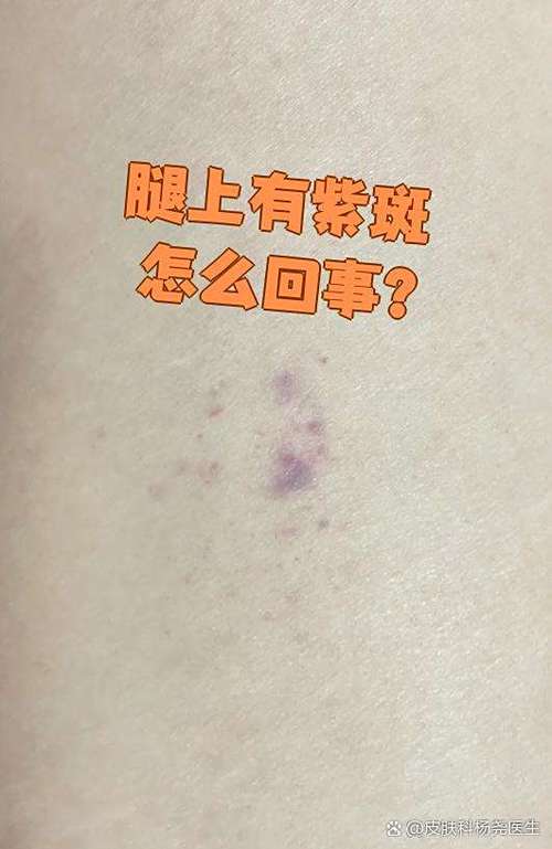 手机屏幕有一片紫斑