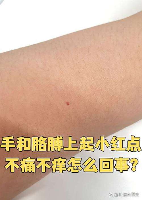 小红点是什么功能