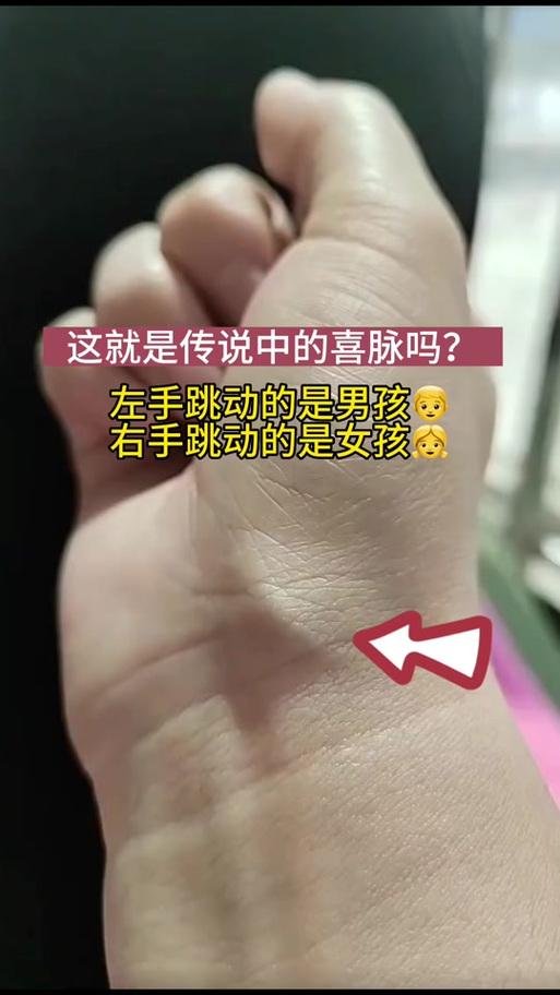 喜脉洗脉照片 喜脉洗脉照片