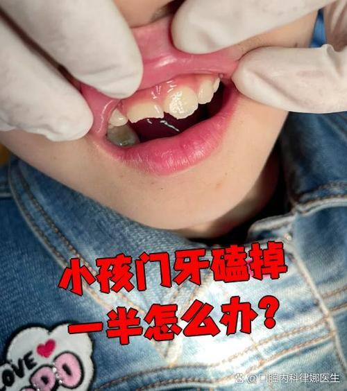 9岁小孩牙齿磕掉一小块截图3