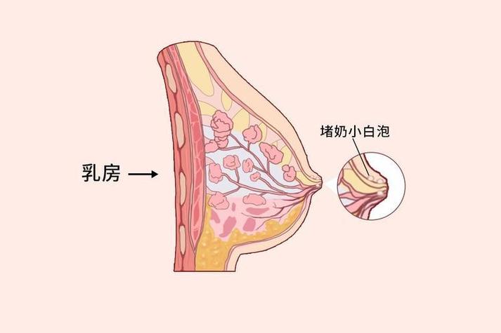出奶孔堵住了截图3