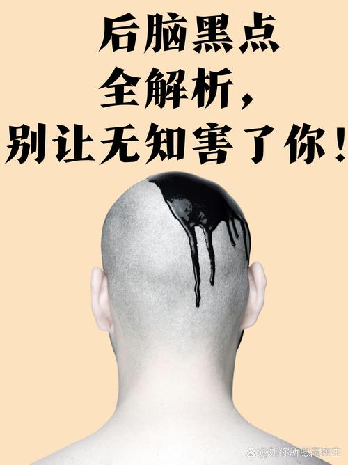 打印机打印出来有黑点怎么回事