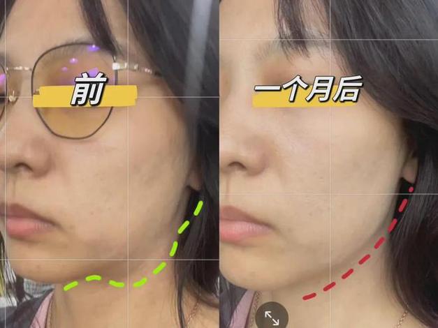 瘦脸怎么瘦最快