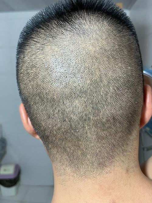 光头强工作日志 光头强工作日志