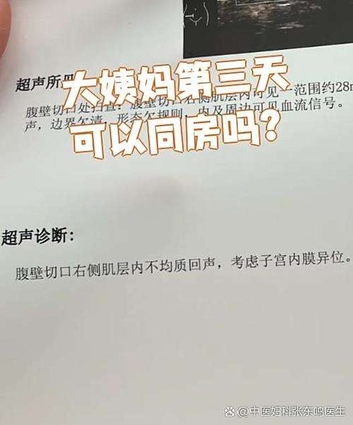 月经第三天可以同房吗截图2