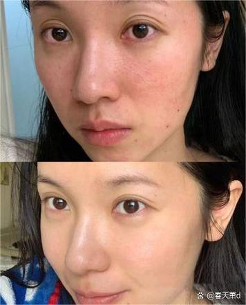 面部啫喱不能乱用 面部啫喱不能乱用