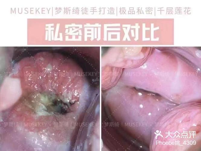 设为私密怎么打开