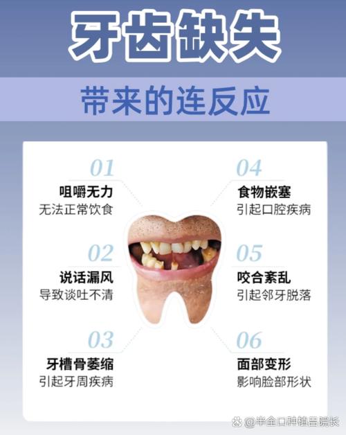 长期缺牙的危害有哪些