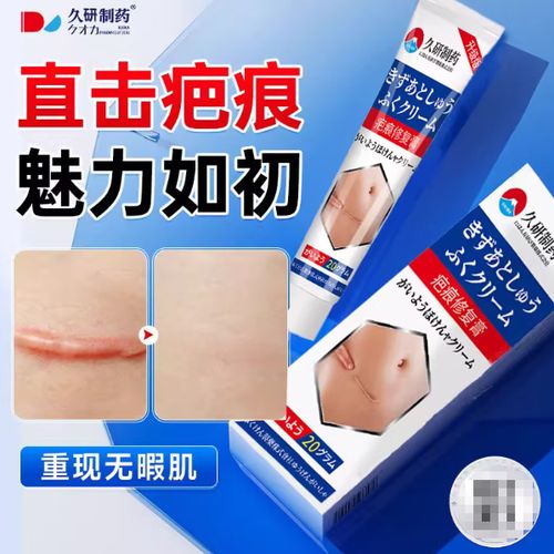 黑印疤痕怎么去除截图3