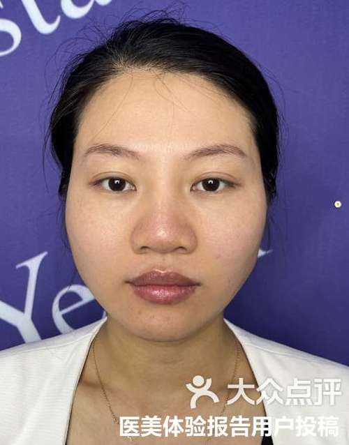 水言瘦脸真的有效果吗