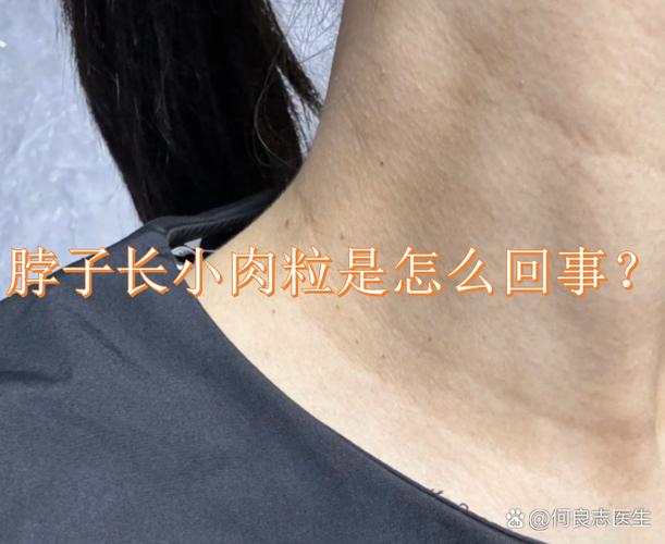 脖子上有一圈肉要警惕