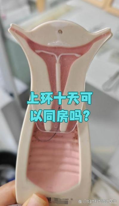 上环几天能同房截图2