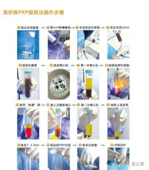 骨科prp一针的费用