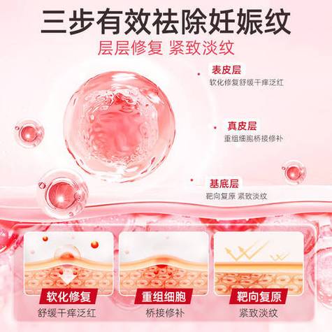擦什么可以淡化妊娠纹