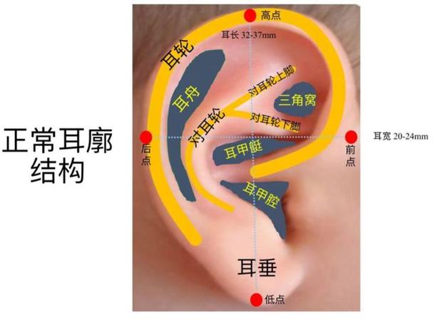 一只耳朵畸形算残疾吗