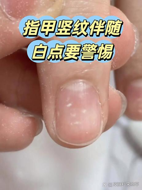 身体出现小白圆点是怎么回事