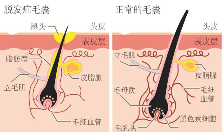 育发液用了毛囊会坏吗
