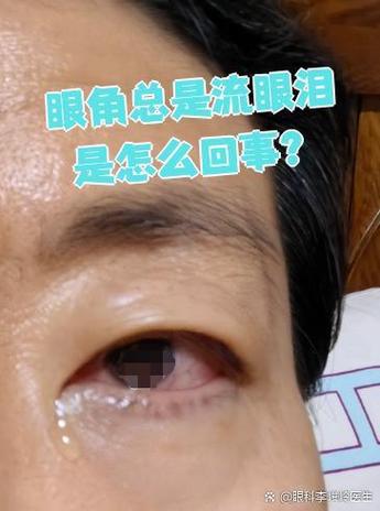 女生撕腿疼哭截图3