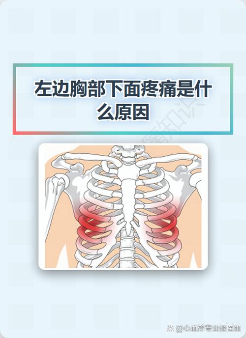 女性左侧肋下疼痛图解