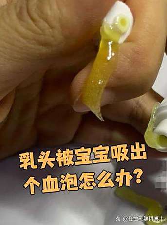 奶里有血丝宝宝能喝吗