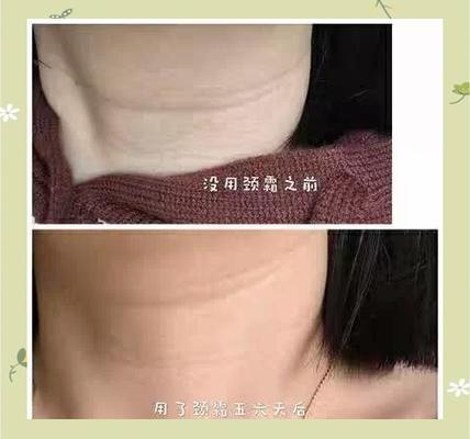 颈纹抹颈霜有用吗