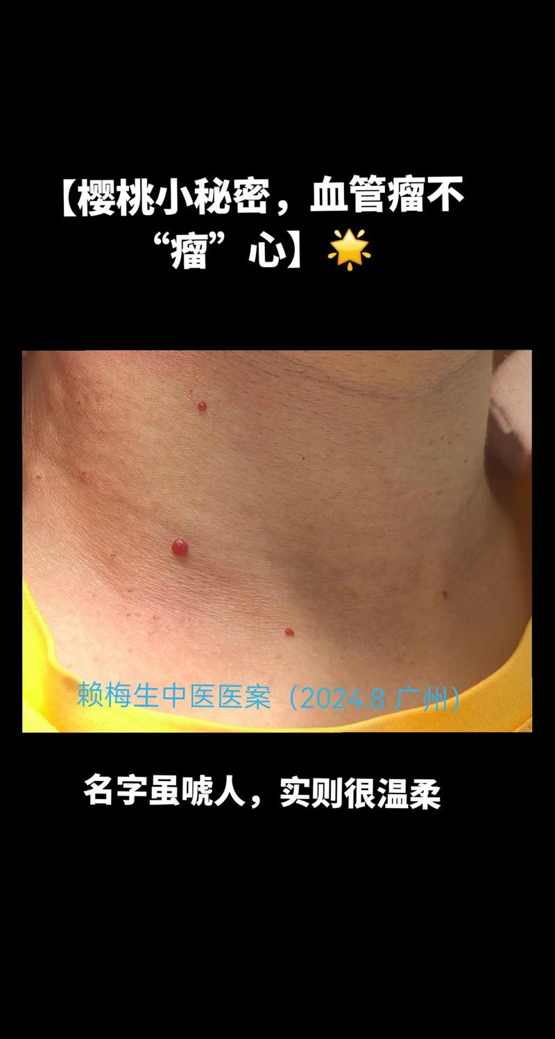 樱桃红点与欧姆龙红点
