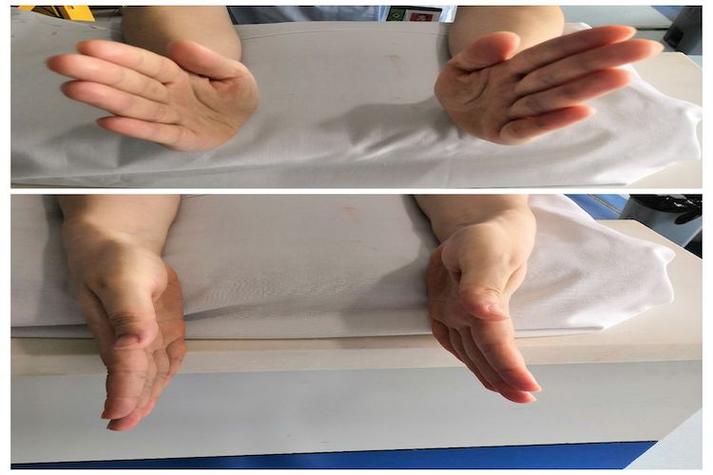 手腕康复训练视频教程