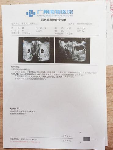 自制b超报告假图片截图2