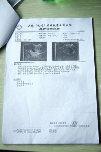 自制b超报告假图片截图3