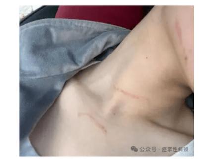 脖子扭断截图3