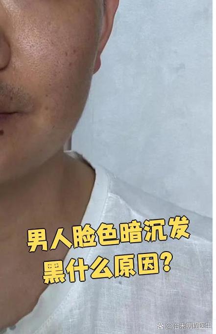 男人敢黑着脸说明了什么