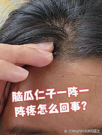脑瓜突然疼怎么回事