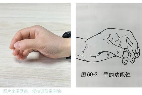 手指康复训练视频截图1
