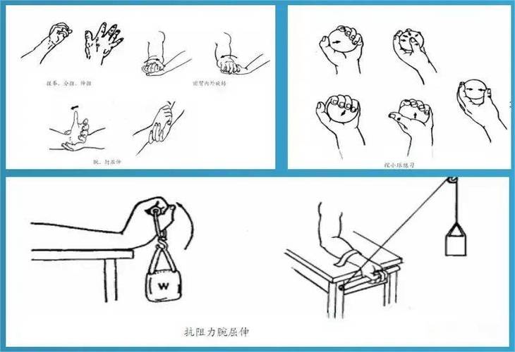手指拔钢针后康复训练