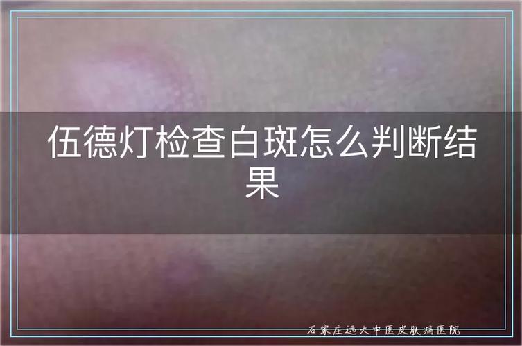 iphone拍照出现白光的原因