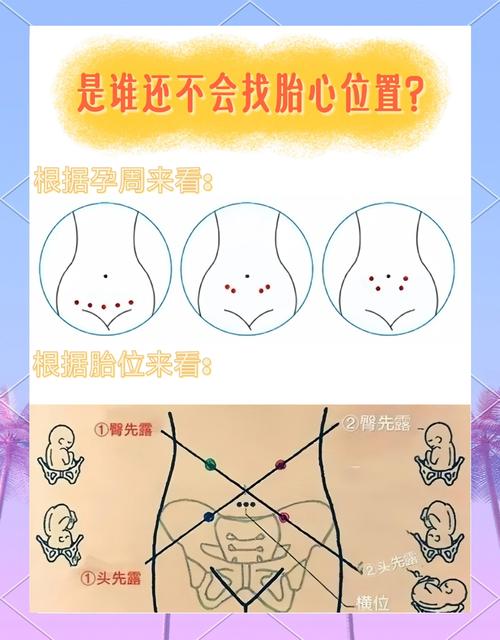 胎心监护NST与CST的区别截图3