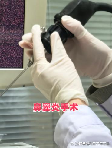 鼻窦炎手术一般要住院几天
