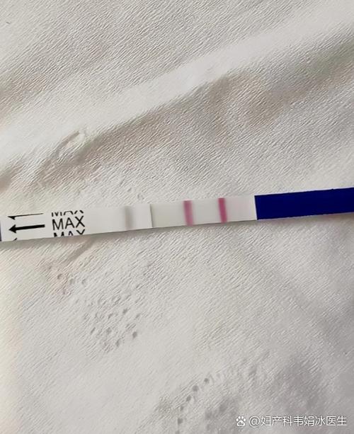 HCG多久测一次