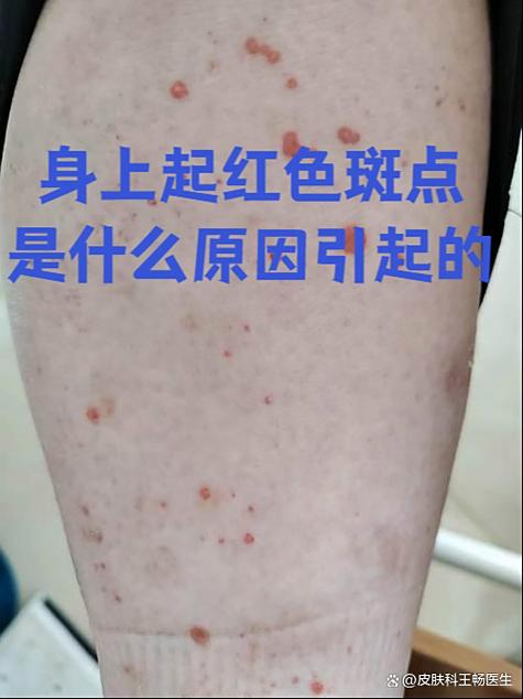 皮肤有红点是怎么回事