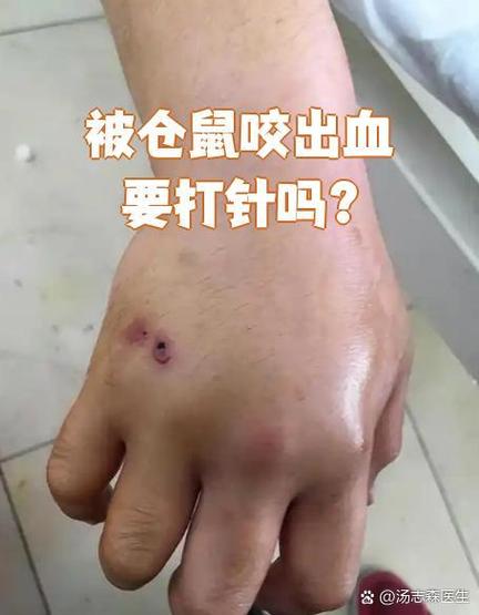 被小仓鼠咬破皮有事吗