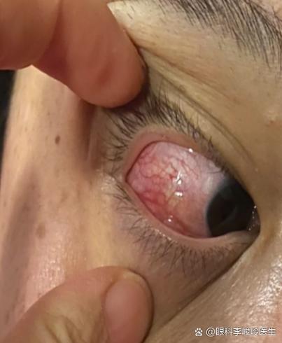 烙铁焊锡对眼睛有影响吗
