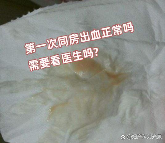 月经同房有什么危害截图3