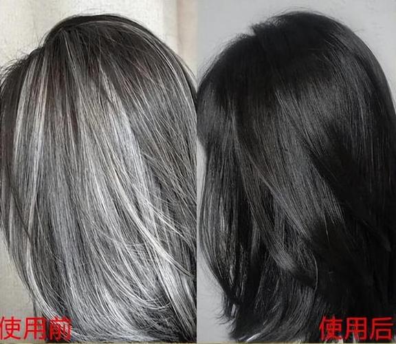 白发真能变黑吗
