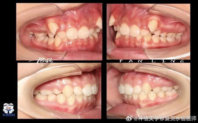 我是小虎牙
